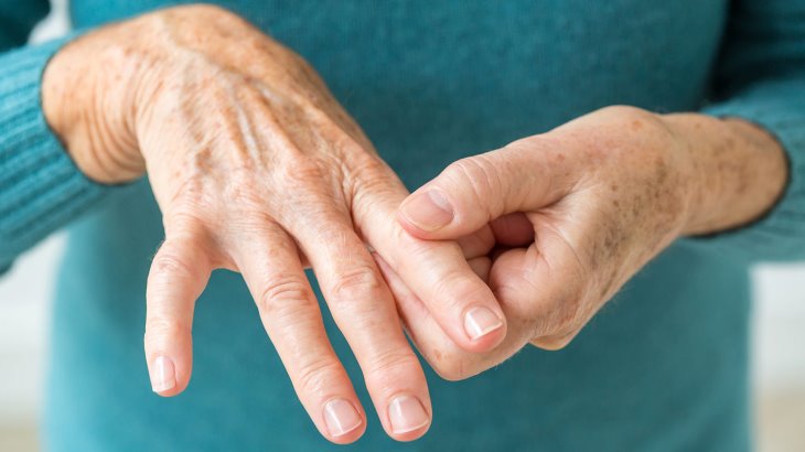 Rheumatoid Arthritis cure